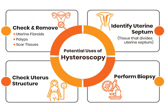 Hysteroscopy