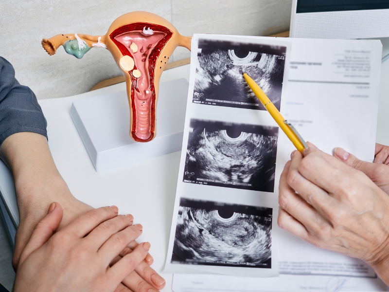 Gynaecological checkup